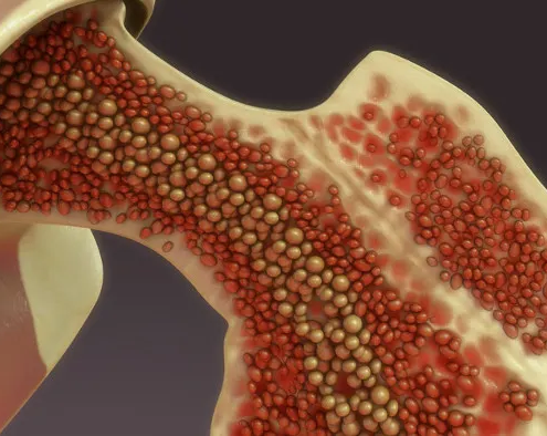 Medula Óssea, Medula Espinhal e Transplante de Medula