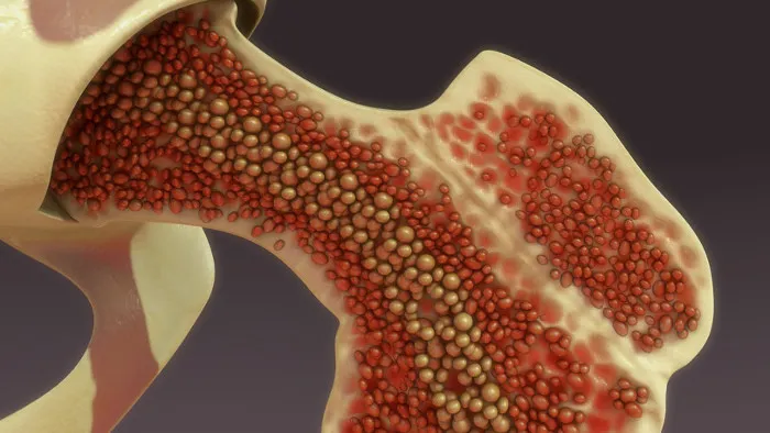 Medula Óssea, Medula Espinhal e Transplante de Medula